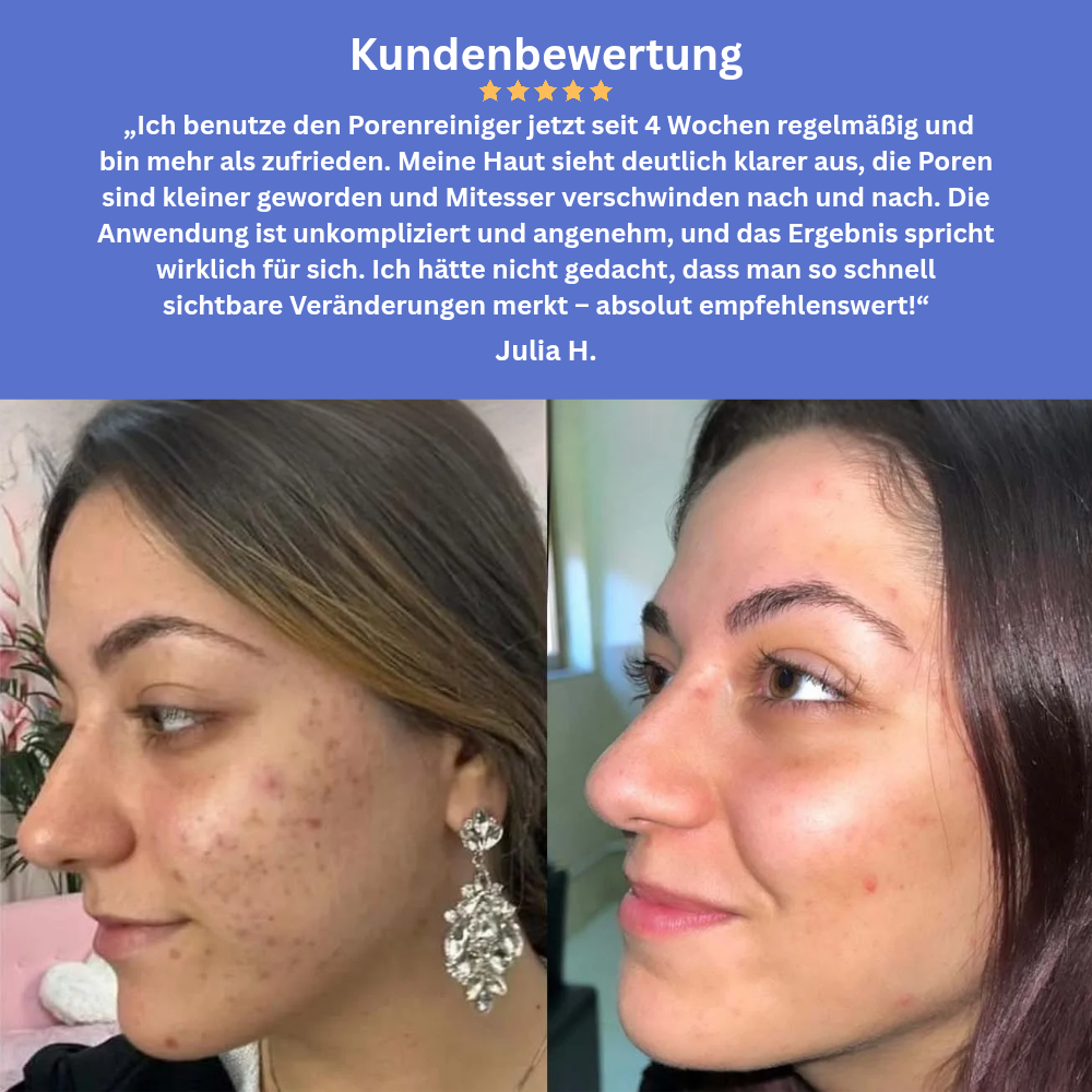 Clarivon - Porenreiniger