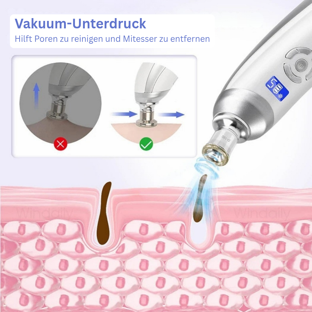 Clarivon - Porenreiniger