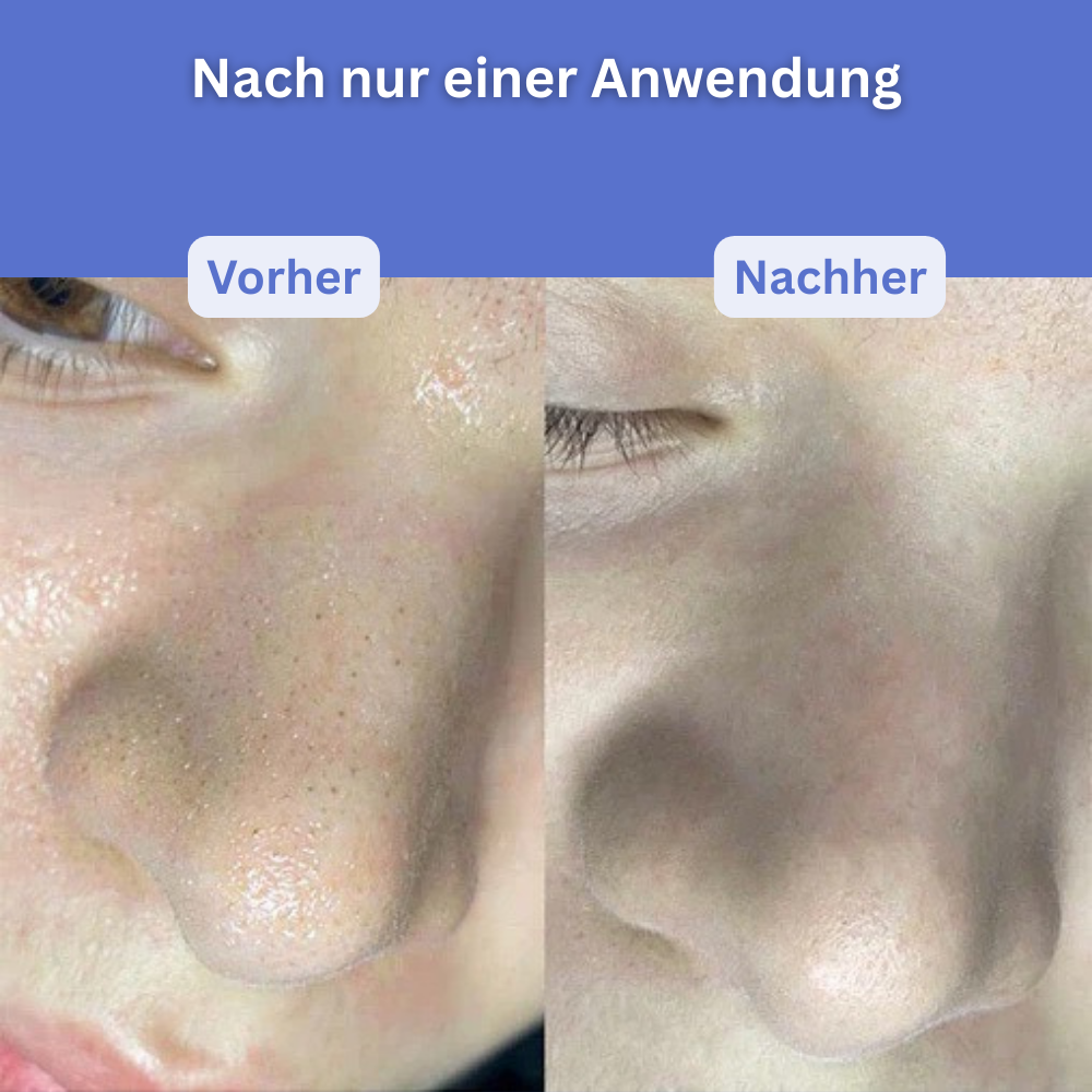 Clarivon - Porenreiniger